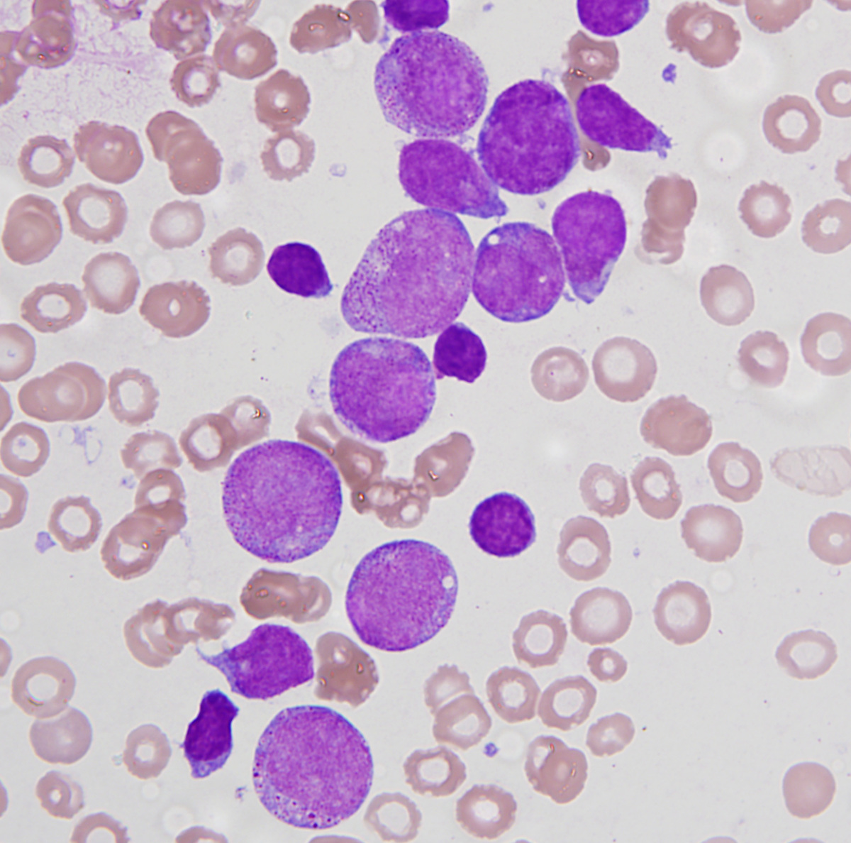 Figure 2 Aspirate High power